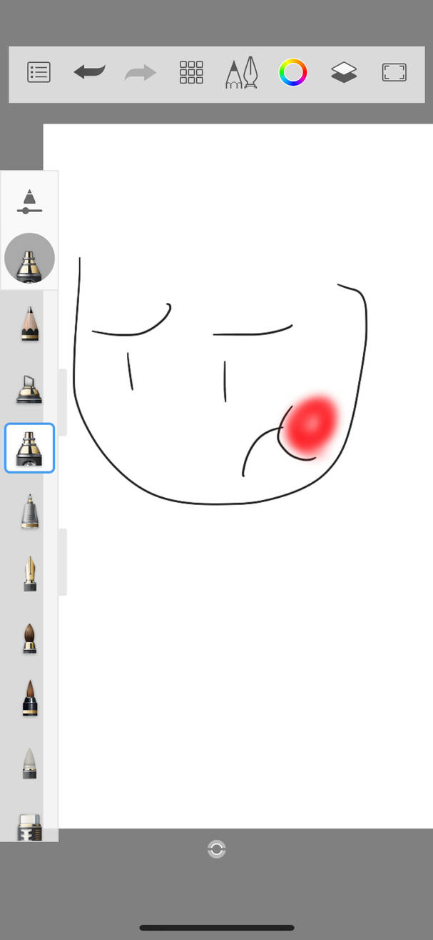 Rooftop Of My Mouth Hurts