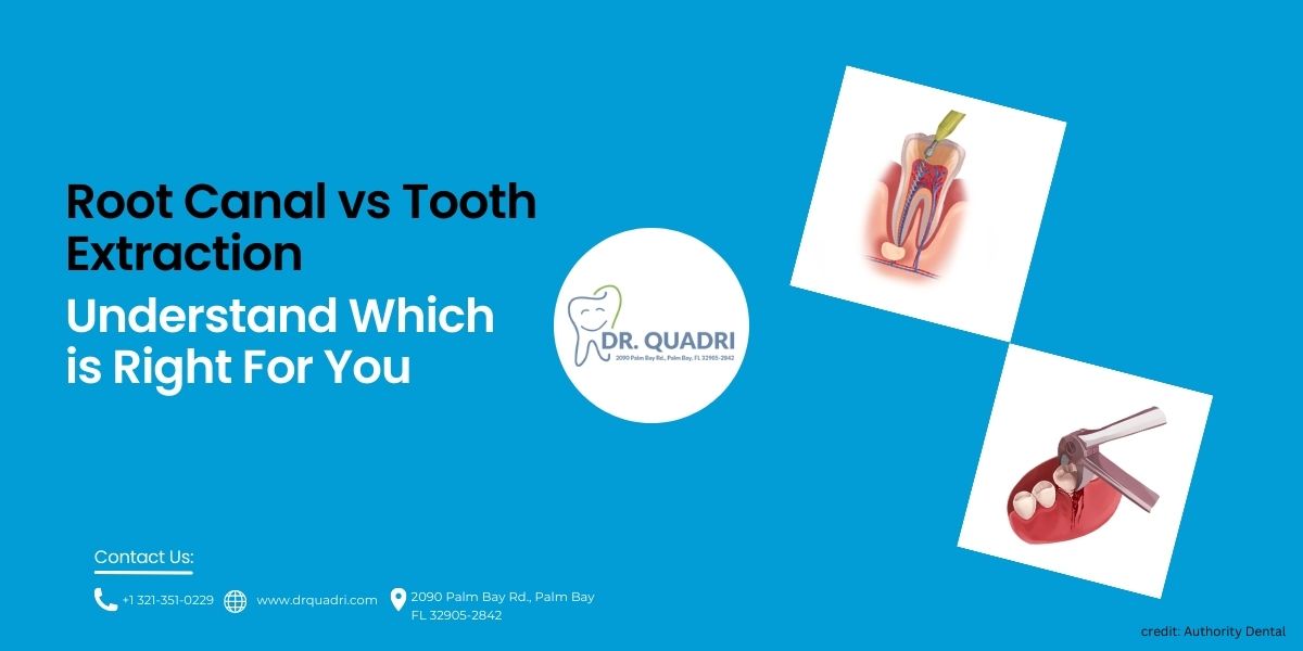 Root Canal Extraction