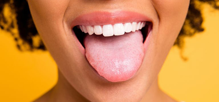 Scalloped Tongue Cure