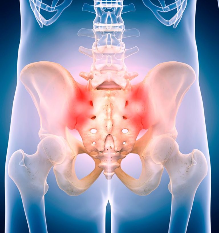 Si Joint Pain Injection