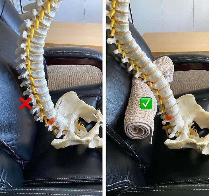 Sinusite: Soulagez Vos Maux De Dents
