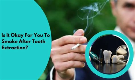 Smoking After Molar Extraction