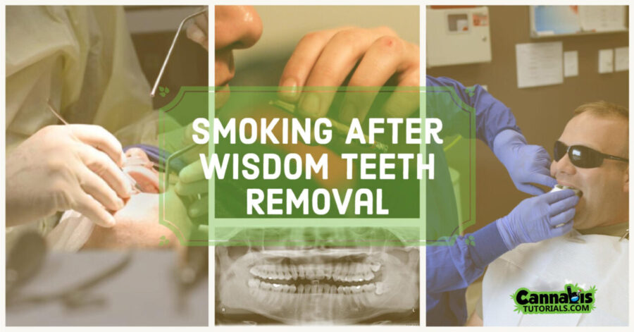 Smoking After Wisdom Teeth Removal: Safe Guidelines