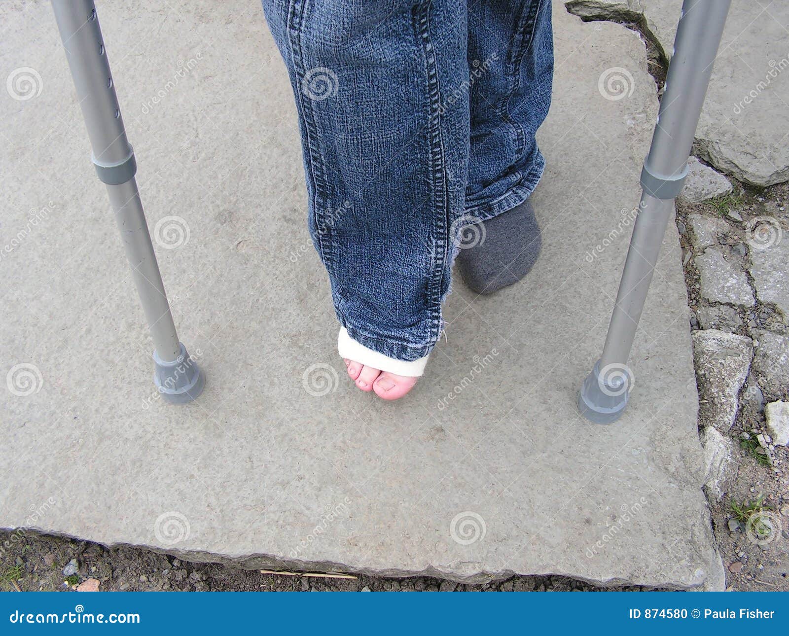 Sprained Ankle And Crutches