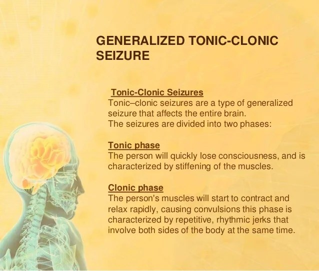 Subclinical Seizures Symptoms