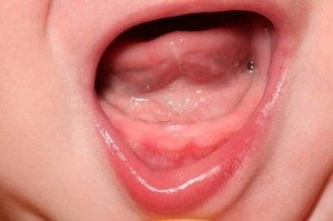 Symptome Bebe Dent Symptome Bebe Dent