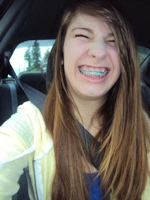 Taking Off Braces Taking Off Braces