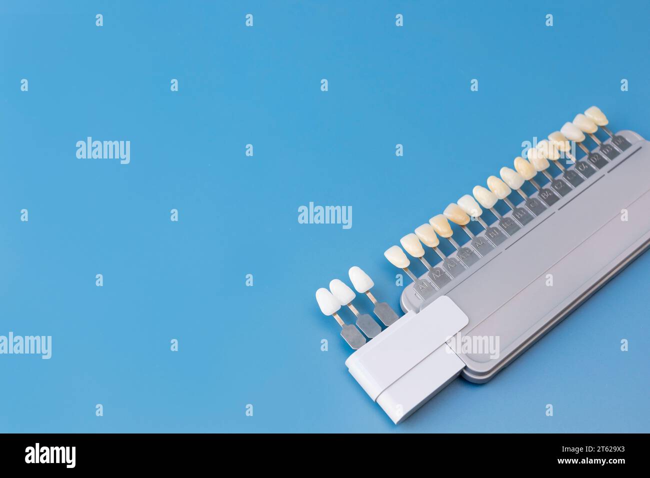 Teeth Whitening Shade Chart