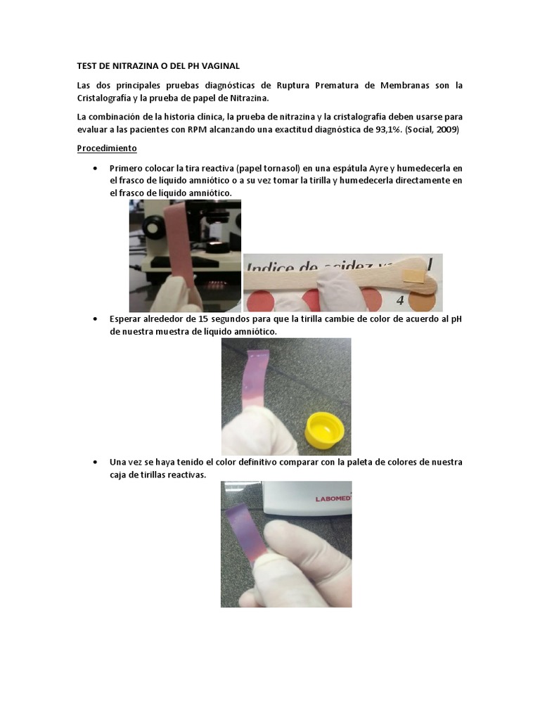 Test De Nitrazina