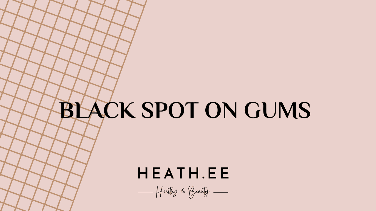 Tiny Dark Spot On Gums