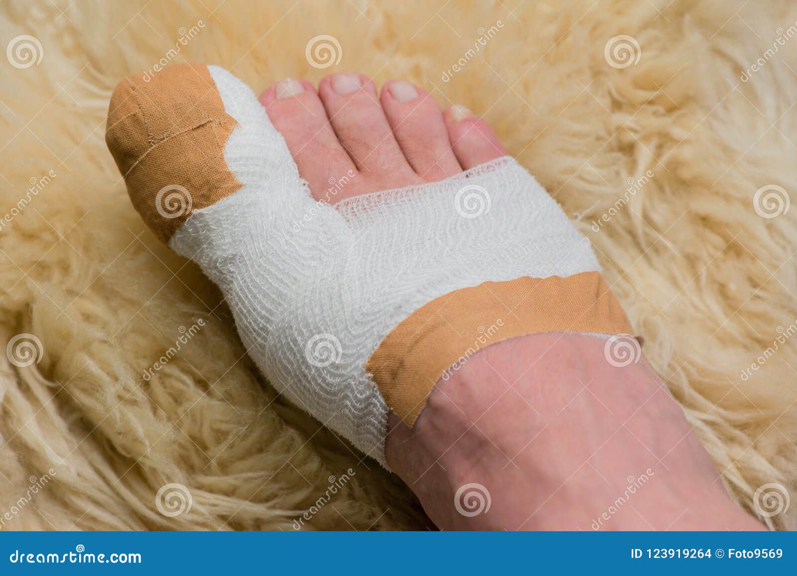 Toe Operation Recovery