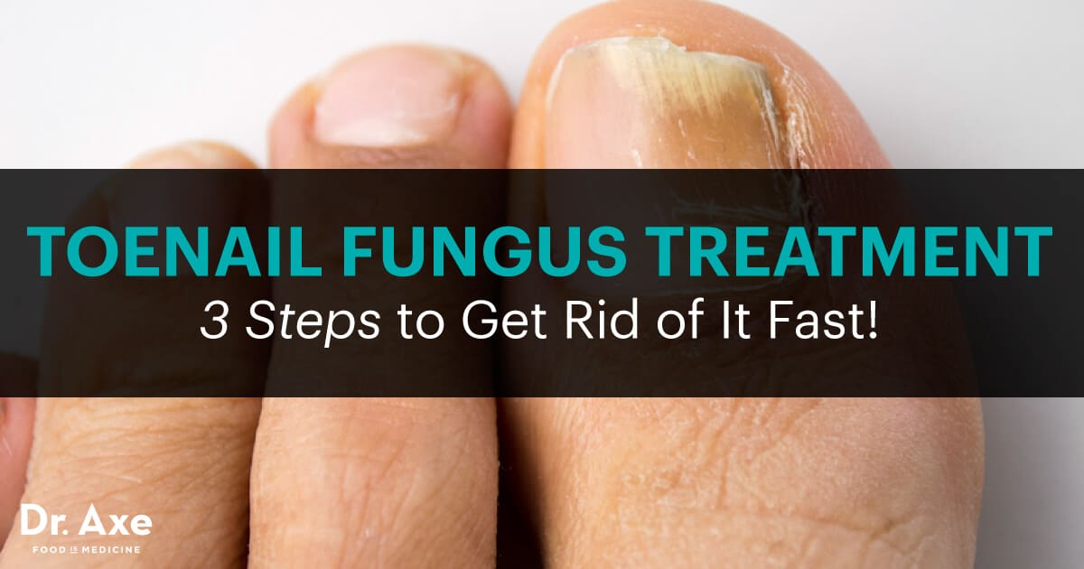 Toenail Fungus Treatment 3 Steps To Get Rid Of It Fast Dr Axe