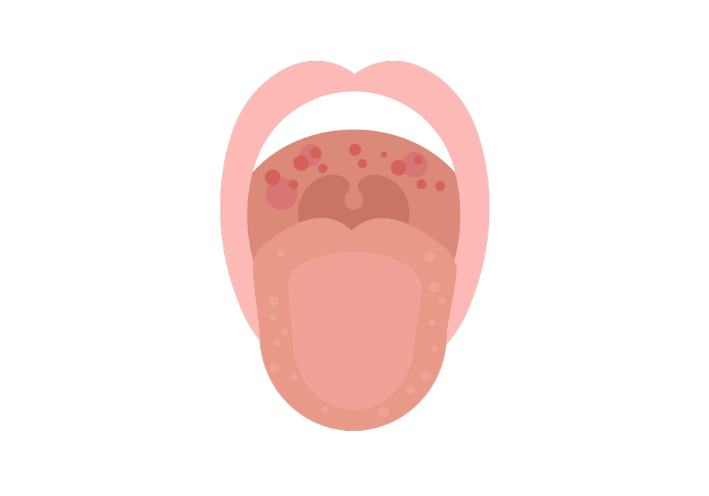 Tongue At Roof Of Mouth