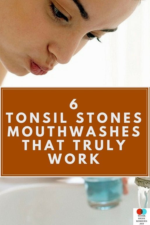 Tonsil Stone Mouthwash
