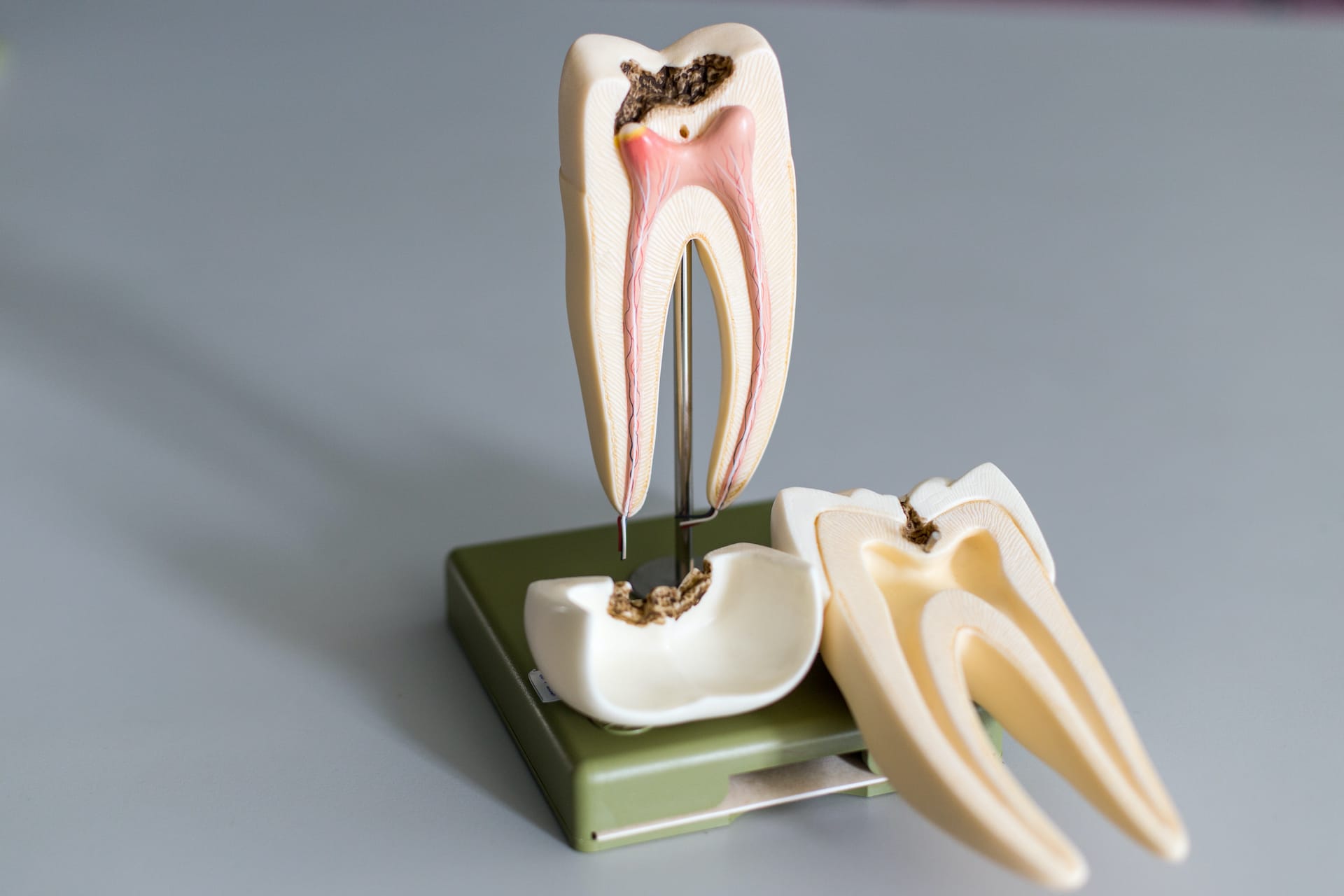 Tooth Infection On Root Canal