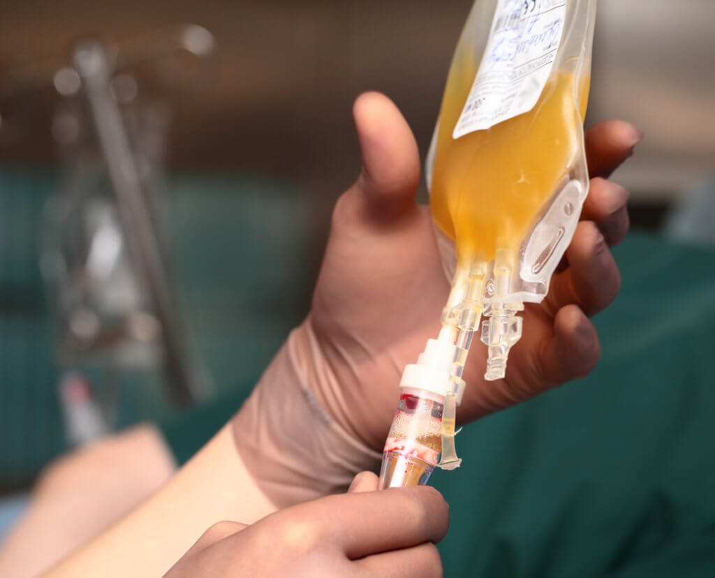 Transfusión De Plasma Riesgos