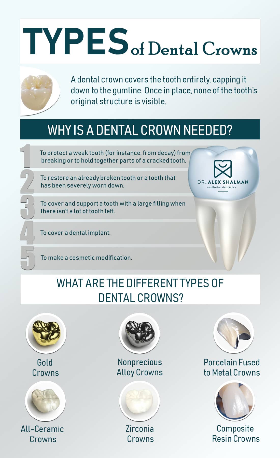 Types Of Crowns