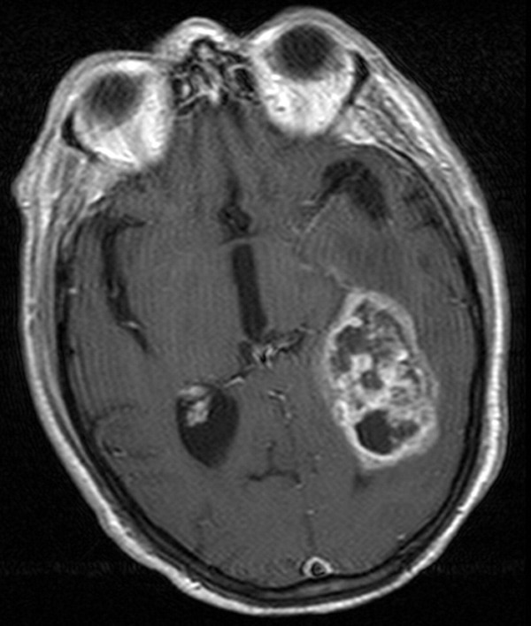 Uc San Diego Health Sciences An Axial Or Horizontal Magnetic Resonance Uc San Diego Health Sciences An Axial Or Horizontal Magnetic Resonance