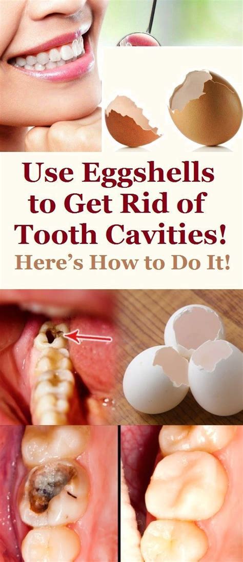 Use Eggshells To Get Rid Of Tooth Cavities Here S How To Do It Use Eggshells To Get Rid Of Tooth Cavities Here S How To Do It