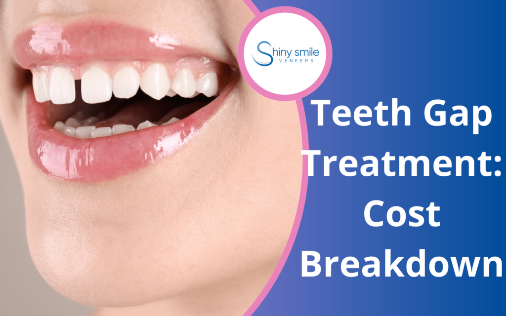 Veneers Cost Breakdown: Save With Options