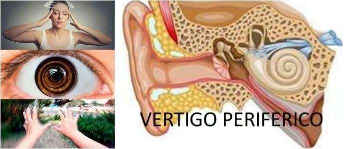 Vértigo Peligroso: Causas Y Síntomas Explicados