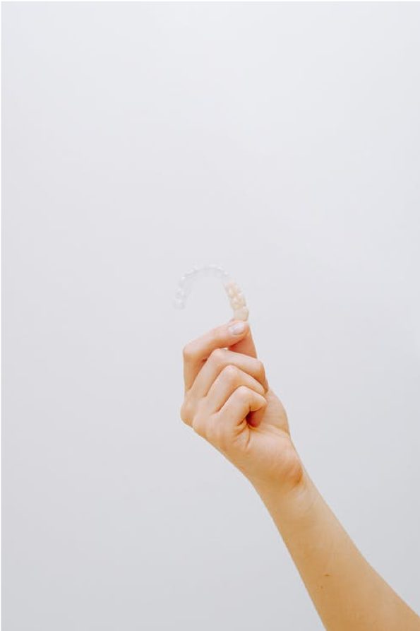 What Are Braces Costs? Affordable Options