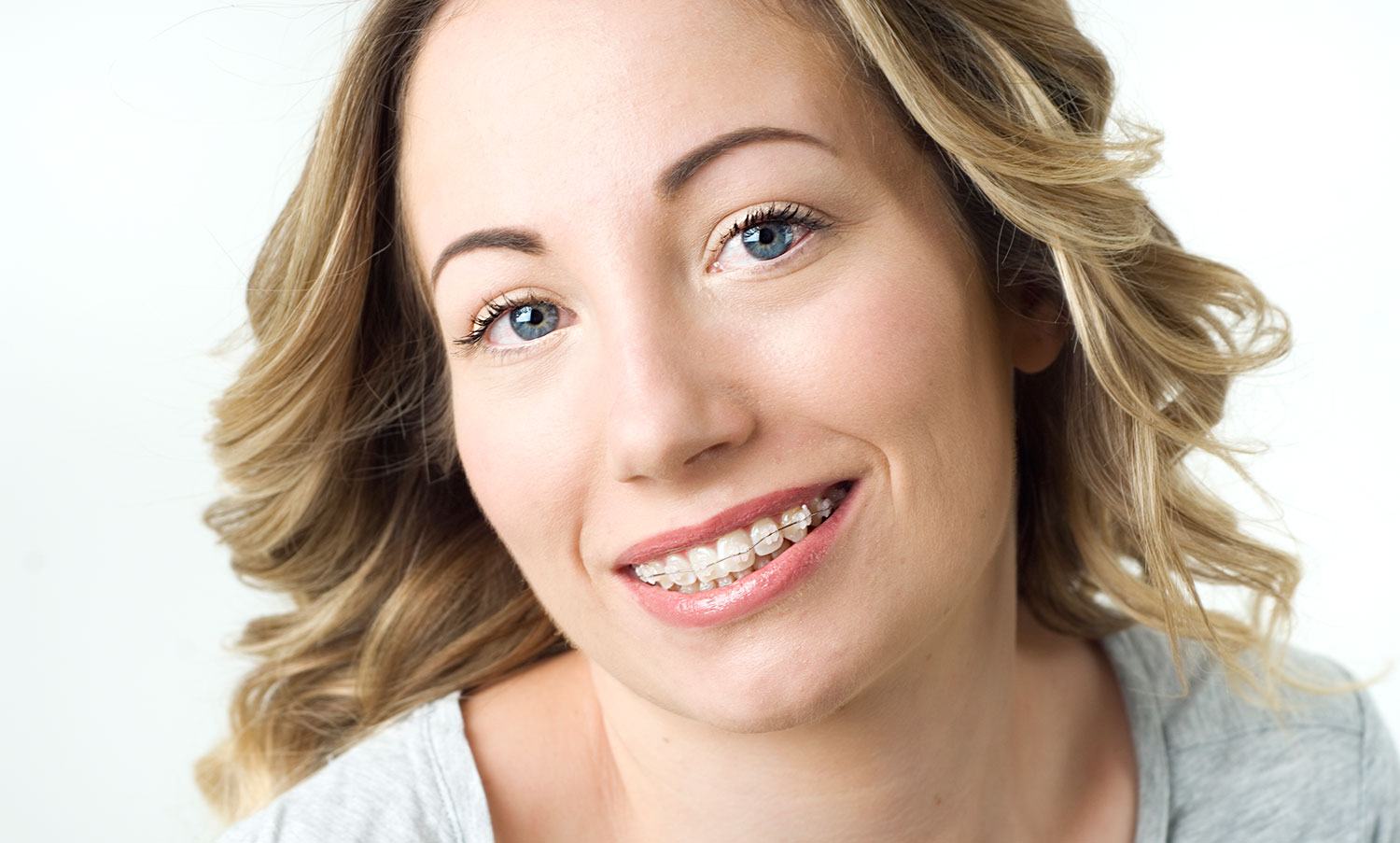 What Are Ceramic Invisible Braces Clear Braces Orthodontics Sydney What Are Ceramic Invisible Braces Clear Braces Orthodontics Sydney
