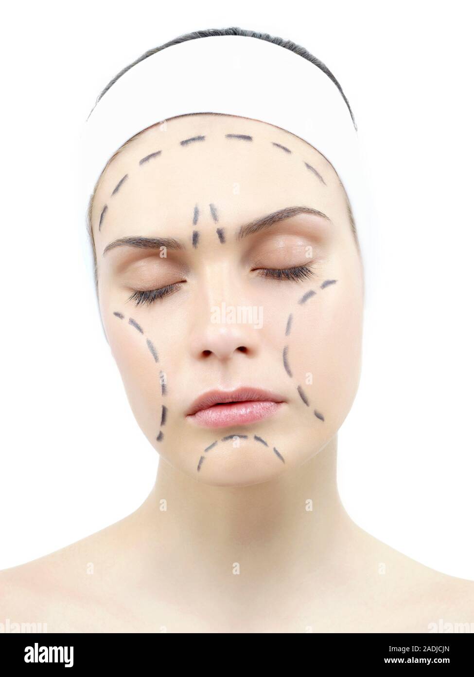 What Are Glued Surgical Incisions? Healing Guide