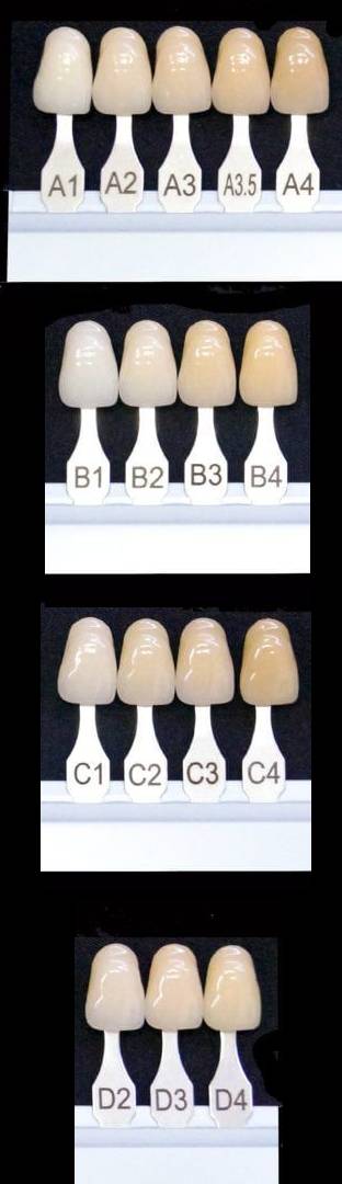 What Are Teeth Shades Chart? Find Your Perfect Smile