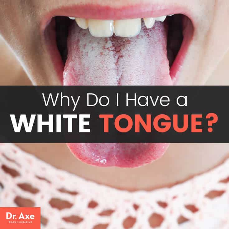What Causes Brown Patch On Tongue? Home Remedies What Causes Brown Patch On Tongue? Home Remedies