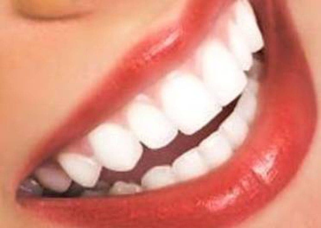 What Causes Bruised Teeth? Relief Solutions