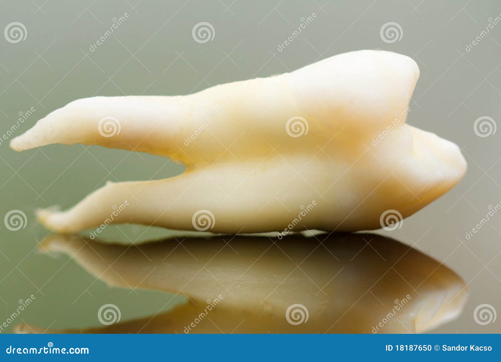 What Causes Curved Tooth Root? Fixing Solutions