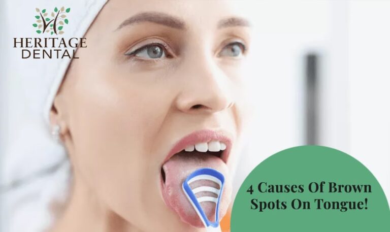 What Causes Dark Spots On Tongue? Removal Tips