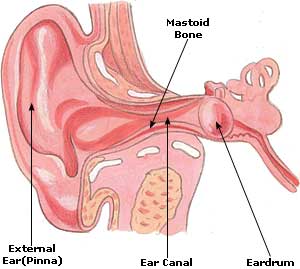 What Causes Earache Sinus? Find Relief