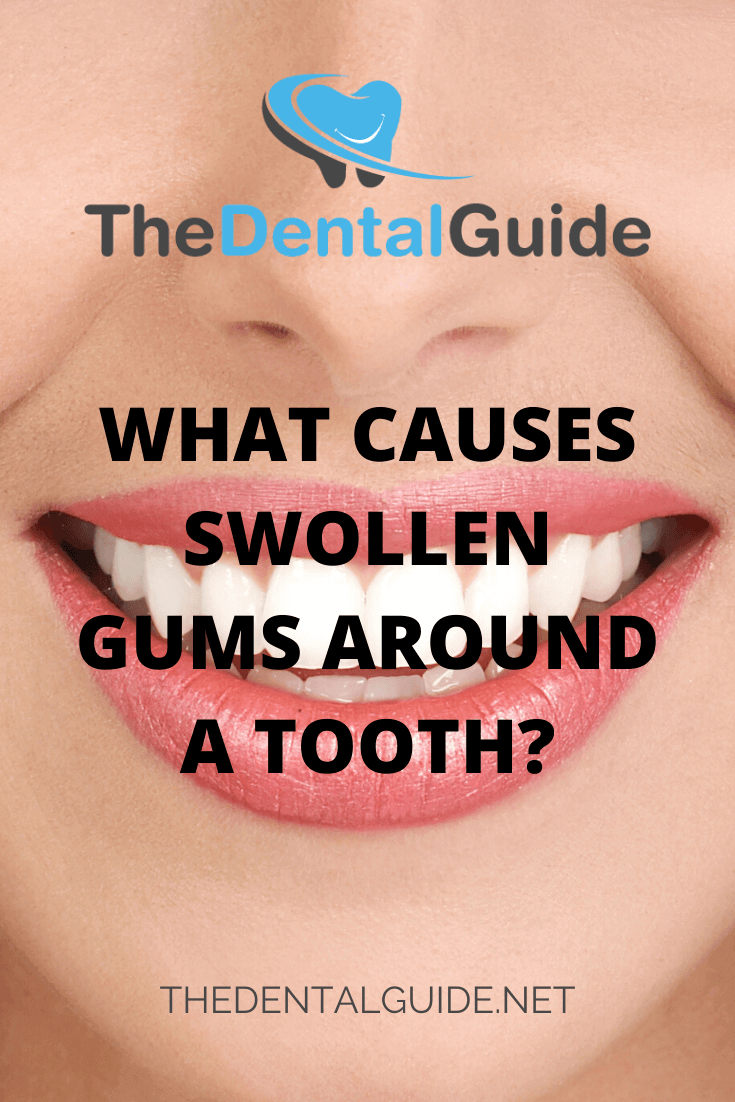 What Causes Fibromas On Gums? Removal Guide What Causes Fibromas On Gums? Removal Guide