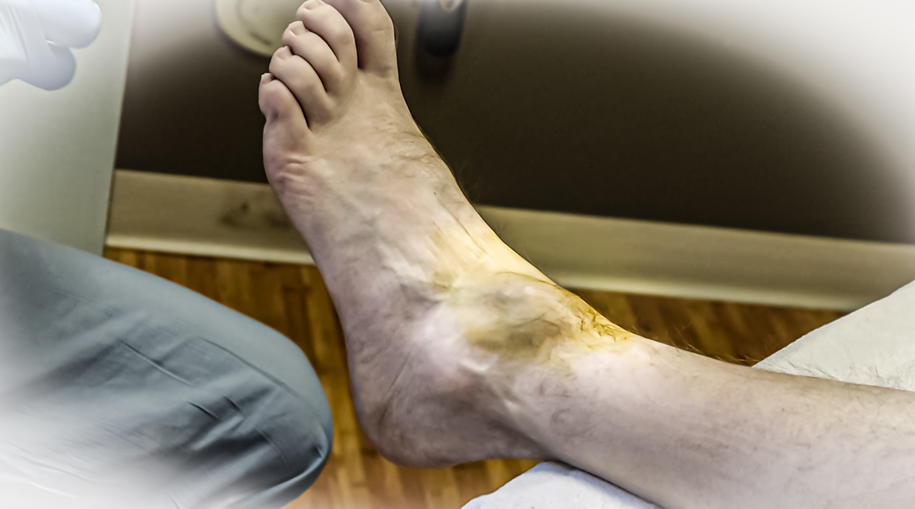 What Causes Ganglion Cyst After Surgery? Recovery Tips