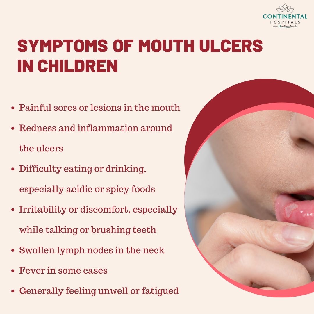 What Causes Mouth Ulcers In Pregnancy? Natural Relief