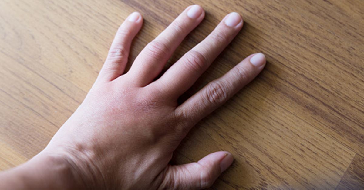 What Causes Swelling? Reduce Pain Now