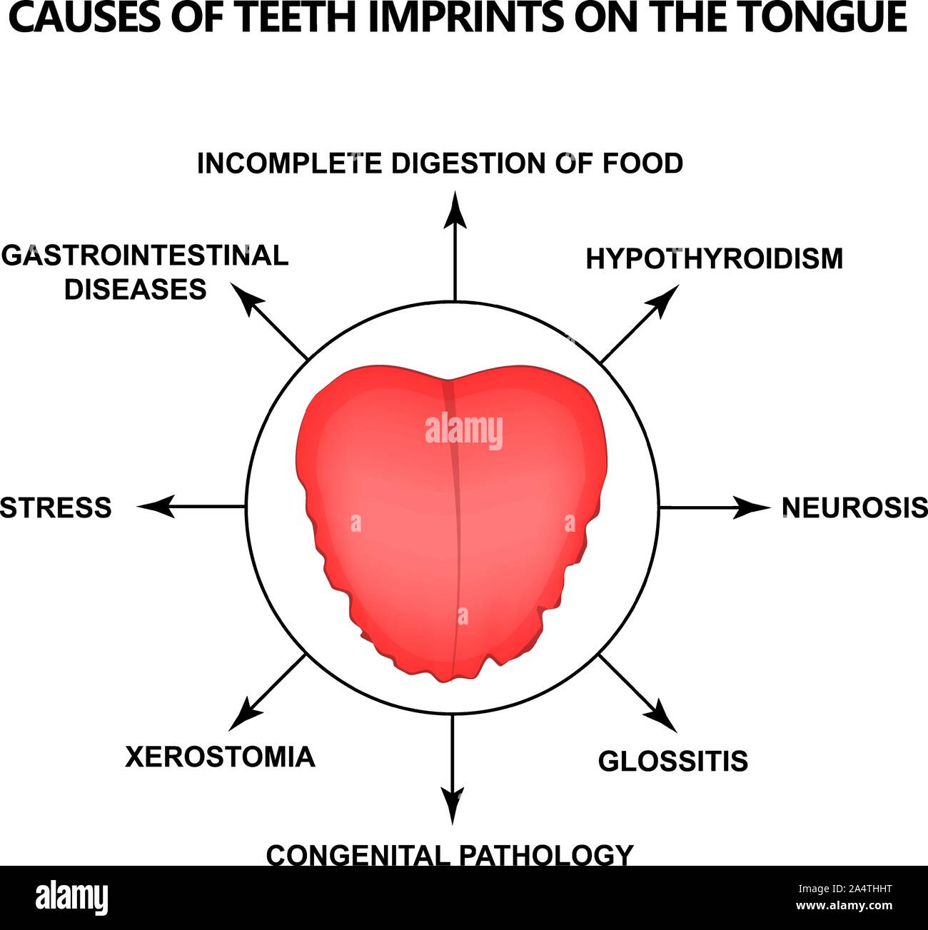 What Causes Teeth Imprint On Tongue? Relief Tips