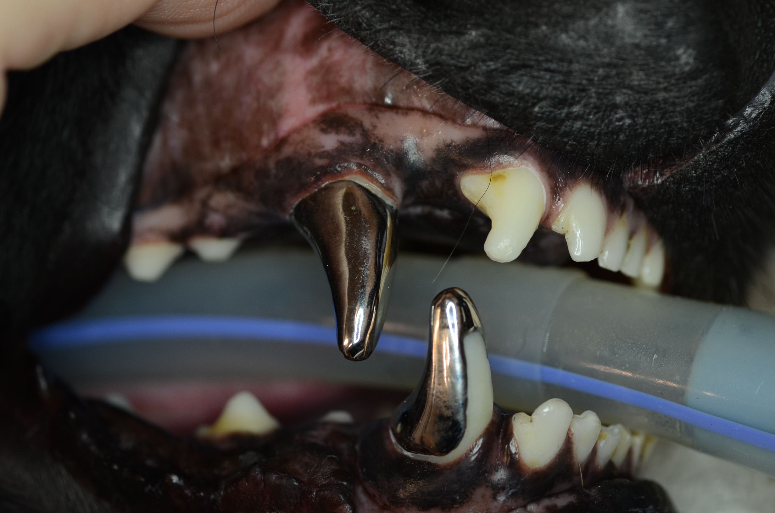 What Do Canine Teeth Do? Enhance Your Smile