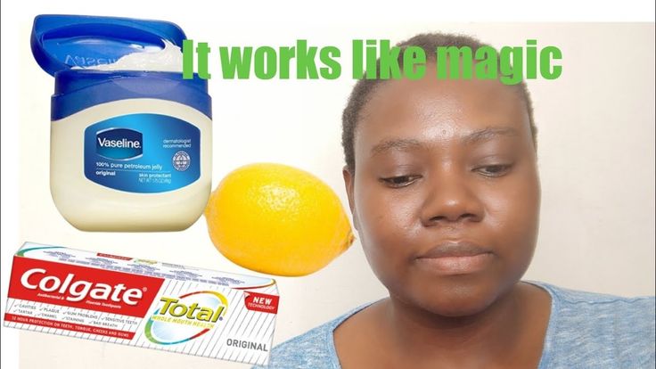 What Happens When Using Colgate Salt And Lemon? Natural Whitening