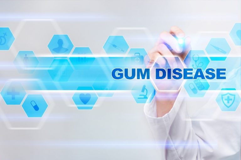 What Helps Gum Disease? Antibiotic Gel Solution