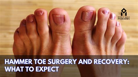 What Hurts After Toe Operation? A Smooth Recovery Guide