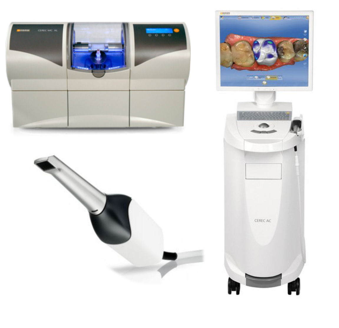 What Is Cerec What Is Cerec