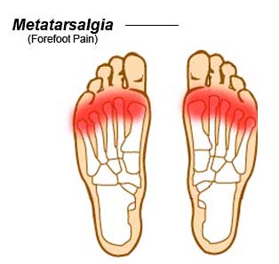What Is Forefoot Location? Find Out Now