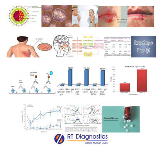 What Is Positive Hsv 1 Igg? Symptoms & Treatment What Is Positive Hsv 1 Igg? Symptoms & Treatment