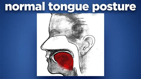 What Is Proper Tongue Positioning? Improve Speech What Is Proper Tongue Positioning? Improve Speech