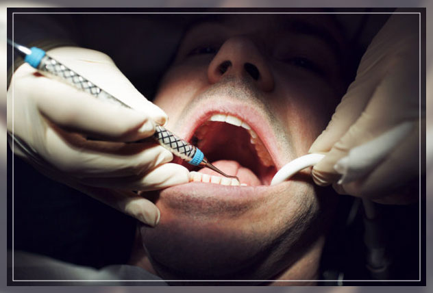 What Is Prophylaxis Dentist
