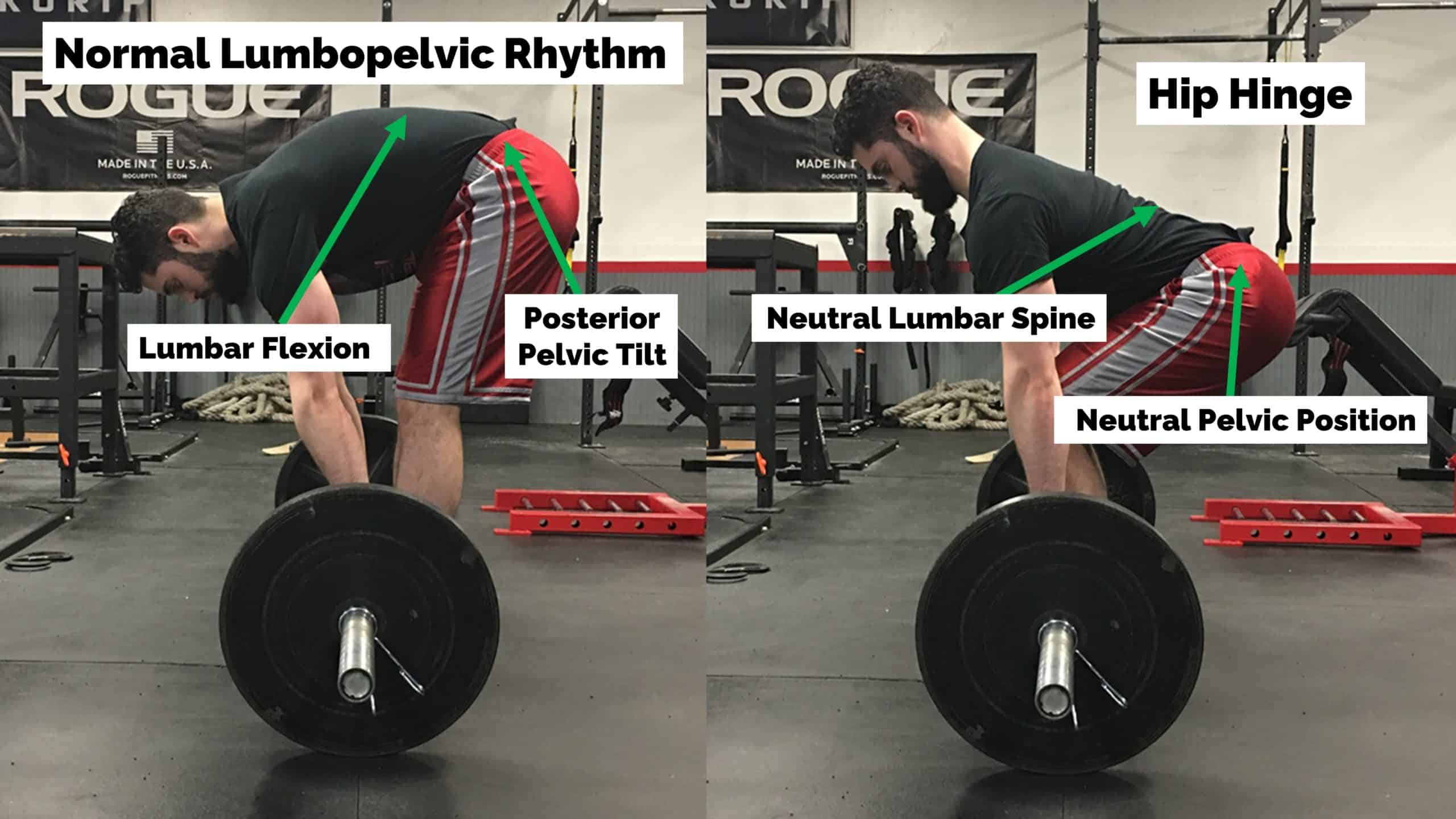 What Is Spinal Flexion
