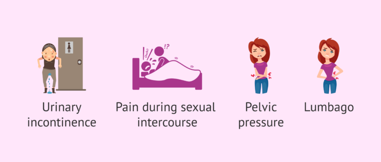 What Is Uterine Prolapse? Symptoms & Treatment What Is Uterine Prolapse? Symptoms & Treatment